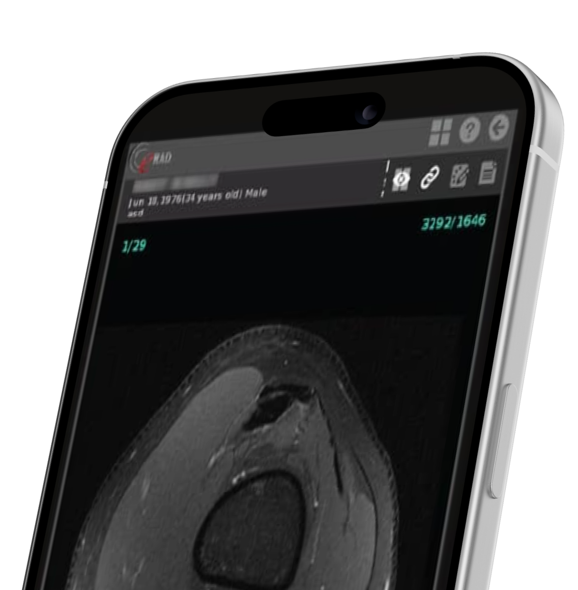 phone top